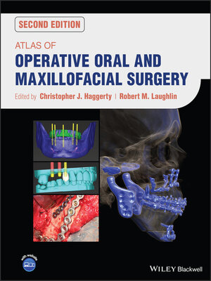 cover image of Atlas of Operative Oral and Maxillofacial Surgery